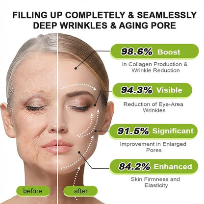 🌿👨‍⚕️Made and shipped from the USA 💫Neslemy® Botox & Vita-A Retinol Shot Wrinkle-Lift Tightening cream - Last Day Promotion 70% OFF