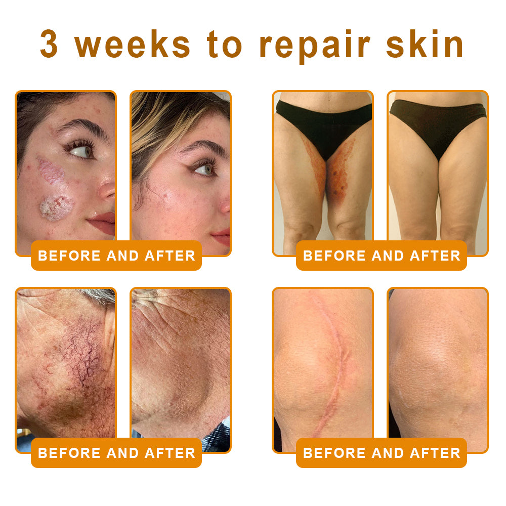 💐🌟💐Made and Shipped from USA ✨ LOVILDS™ Bee Venom Skin Restoration Cream 🔥 LAST DAY 80% OFF
