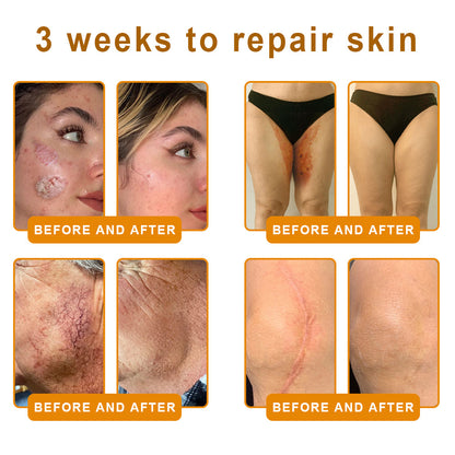 💐🌟💐Made and Shipped from USA ✨ LOVILDS™ Bee Venom Skin Restoration Cream 🔥 LAST DAY 80% OFF