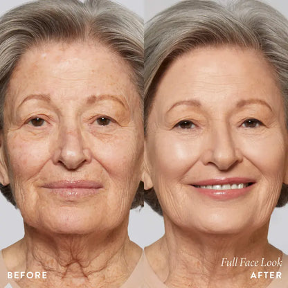 Line Softened Under Eye