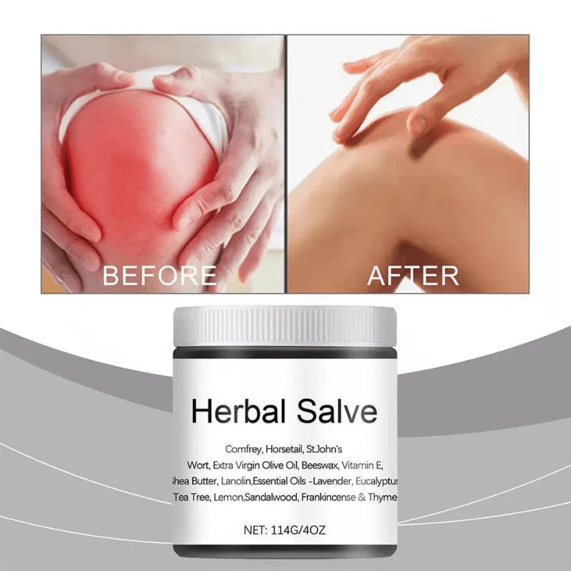Rapid Relief Organic Herbal Salve with Comfrey（副本）