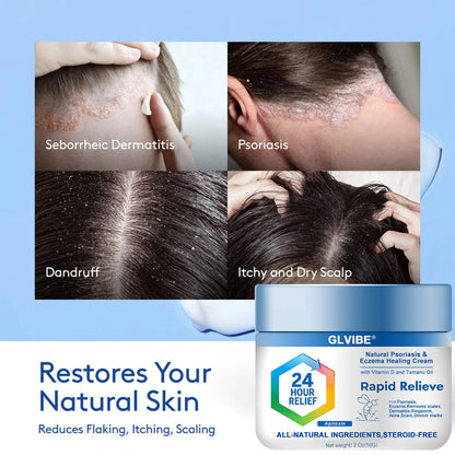 🔥Top Dermatologist: Psoriasis Cure Vitamin D Cream