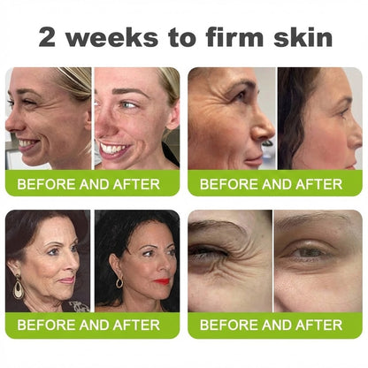 🌿👨‍⚕️Made and shipped from the USA 💫Neslemy® Botox & Vita-A Retinol Shot Wrinkle-Lift Tightening cream - Last Day Promotion 70% OFF