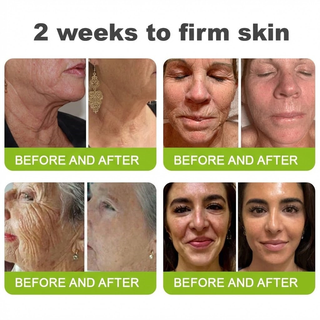 🌿👨‍⚕️Made and shipped from the USA 💫Neslemy® Botox & Vita-A Retinol Shot Wrinkle-Lift Tightening cream - Last Day Promotion 70% OFF