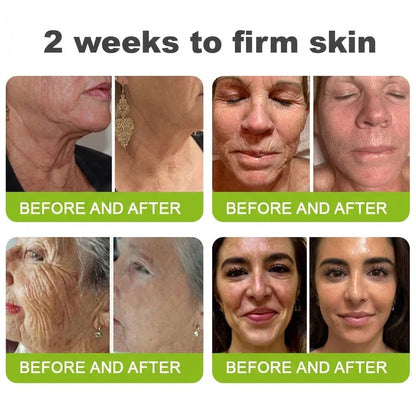 🌿👨‍⚕️Made and shipped from the USA 💫Neslemy® Botox & Vita-A Retinol Shot Wrinkle-Lift Tightening cream - Last Day Promotion 70% OFF