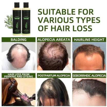 🌱 Organic Rosemary Hair Growth Shampoo🌱