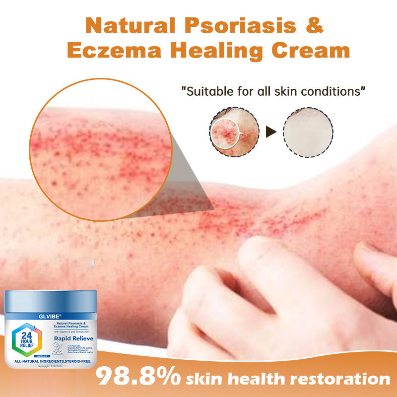 🔥Top Dermatologist: Psoriasis Cure Vitamin D Cream