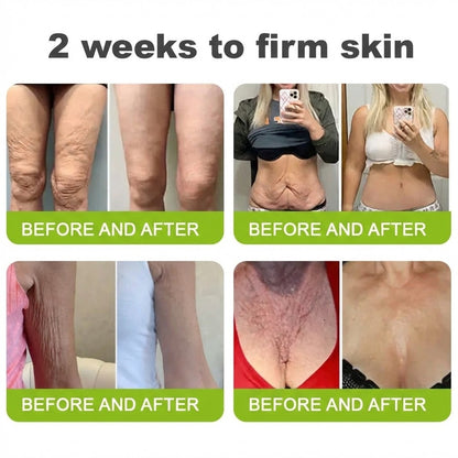 🌿👨‍⚕️Made and shipped from the USA 💫Neslemy® Botox & Vita-A Retinol Shot Wrinkle-Lift Tightening cream - Last Day Promotion 70% OFF