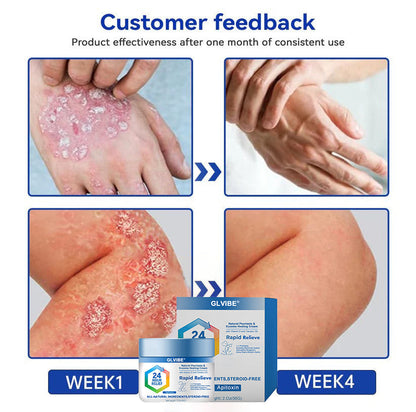🔥Top Dermatologist: Psoriasis Cure Vitamin D Cream