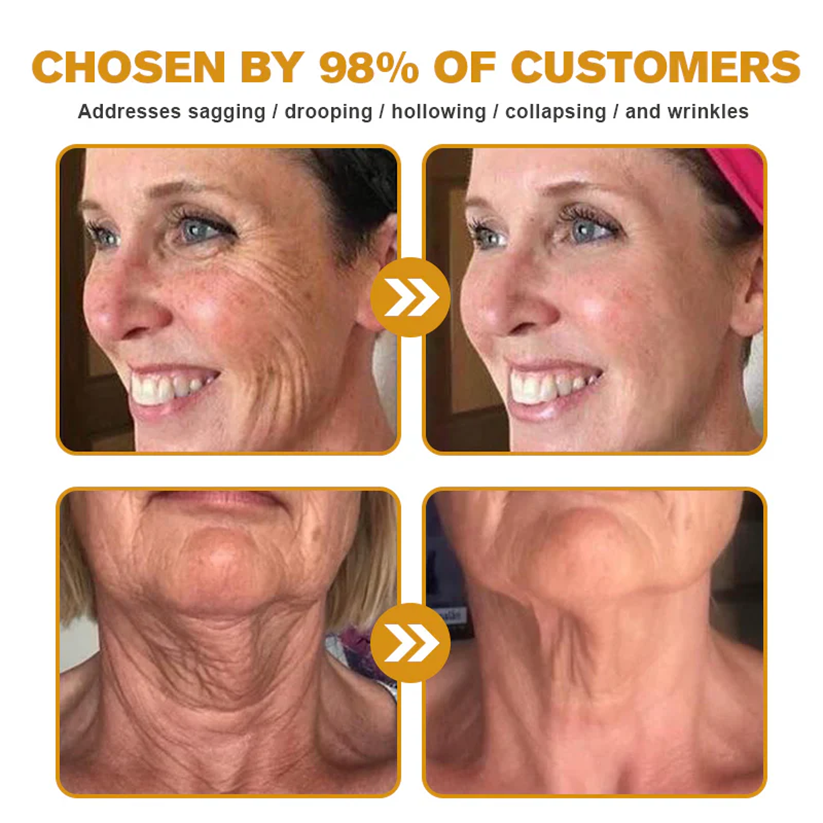 💐🌟💐Made and Shipped from USA ✨ LOVILDS™ Bee Venom Skin Restoration Cream 🔥 LAST DAY 80% OFF