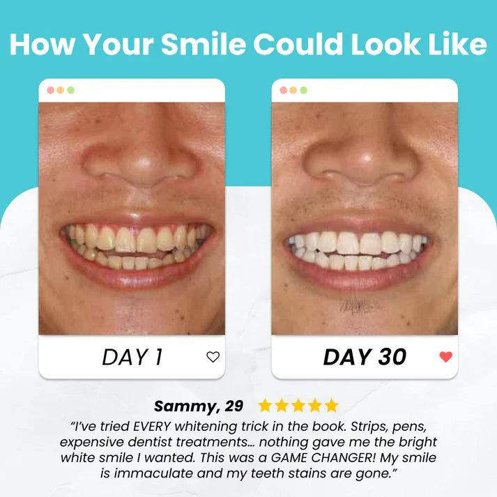 MOONBIFFY Smart Toothbrush Fast Cleaning! 30s Smile Magic