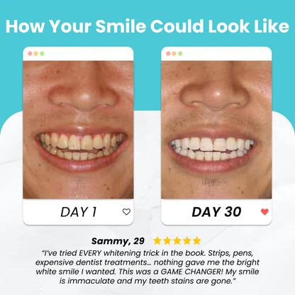 MOONBIFFY Smart Toothbrush Fast Cleaning! 30s Smile Magic