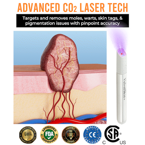 💎QIAWI™ All-in-One CO₂ Laser Eraser Pen | Removes Moles, Warts, Skin Flaws & Pigmentation