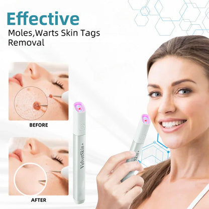 💎QIAWI™ All-in-One CO₂ Laser Eraser Pen | Removes Moles, Warts, Skin Flaws & Pigmentation