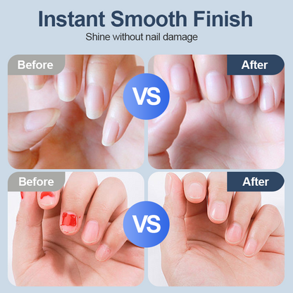 💅✨ Universal Automatic Fingernail Grinder - 6 Speed Settings with 5 Attachments for Safe & Gentle Nail Care 👶🔧
